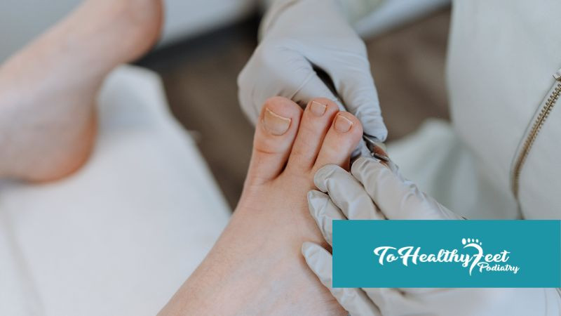 Common Mistakes in Ingrown Toenail Care and How to Avoid Them